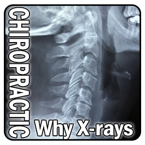 Why chiropractic x-rays?