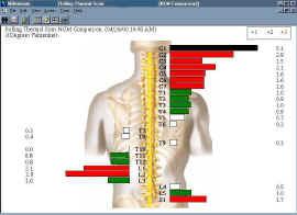 Thermal scan as seen at Braile Chiropractic across from Marietta HS