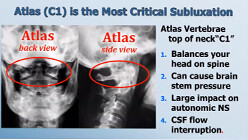 What causes subluxation